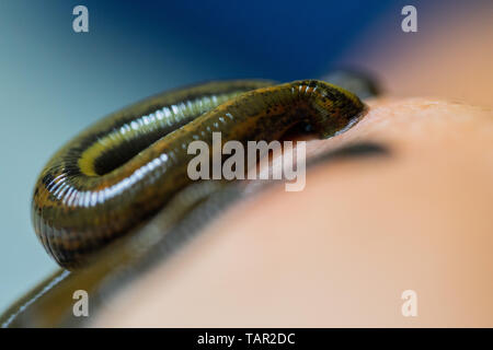 Düsseldorf, Deutschland. 27. Mai, 2019. Blutegel sitzen auf den Arm des Patienten während einer Blutegel Therapie in der Orthonatura Practice Group. Credit: Rolf Vennenbernd/dpa/Alamy leben Nachrichten Stockfoto