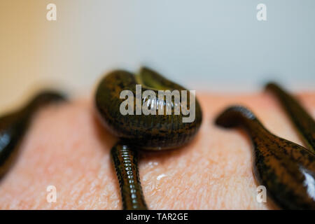 Düsseldorf, Deutschland. 27. Mai, 2019. Blutegel sitzen auf den Arm des Patienten während einer Blutegel Therapie in der Orthonatura Practice Group. Credit: Rolf Vennenbernd/dpa/Alamy leben Nachrichten Stockfoto