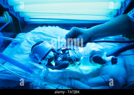 In Blau UV-Licht getaucht, eine Frühgeburt wird durch ein Krankenhaus Pflegepersonal überwacht Stockfoto