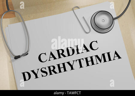 3D-Darstellung von Herzrhythmusstörungen Titel auf ein medizinisches Dokument Stockfoto