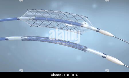 Deflationiert und aufgeblasen Stents und Ballonkatheter, Illustration. Stockfoto