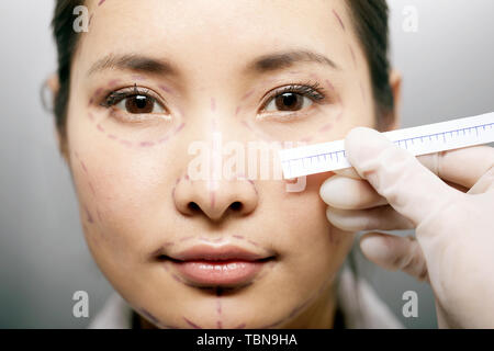 Weibliche kosmetische Chirurgie Stockfoto