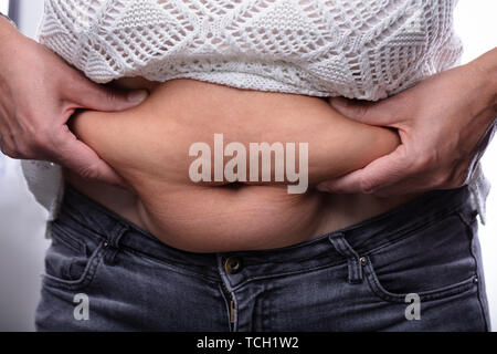 In der Nähe von Frau drückende Bauch Fett mit Ihren beiden Händen Stockfoto