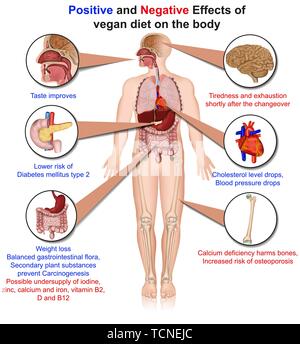 Positive und negative Auswirkungen der veganen Ernährung, 3d medical Vector Illustration Stock Vektor