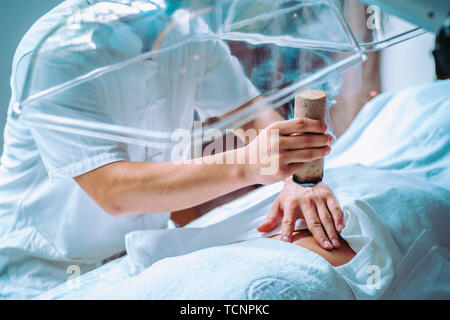 Moxibustion Stockfoto