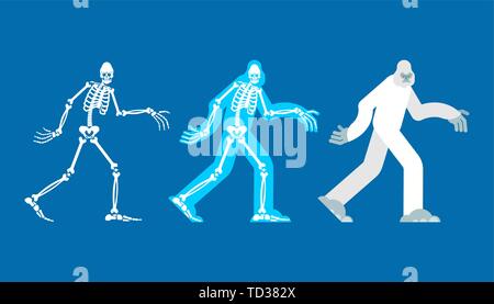 Yeti Skelett islated. Bigfoot Schädel und Knochen. Abominable snowman. sasquatch Bleibt Stock Vektor