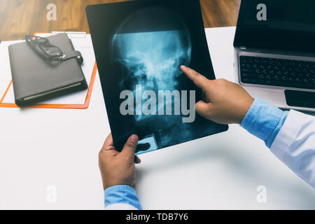 Arzt halten und verweist auf x-ray film des Patienten. Stockfoto