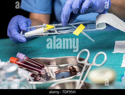 Krankenschwester bereitet Venenkatheter von langer Dauer in einem Krankenhaus, Zugriff auf die Innewohnung Zentralvenösen Linien, konzeptionelle Bild Stockfoto