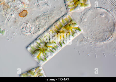 Diatomeen (Kieselalgen Diatomeae), Wohnzimmer von West Island, im Differential Interferenz Kontrast, x120, Island Stockfoto