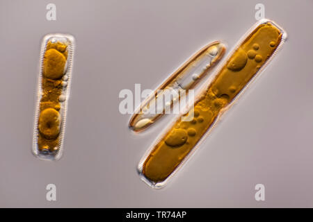 Diatomeen (Kieselalgen Diatomeae), Wohnzimmer von Tessin, in differential Interferenz Kontrast, x160, Schweiz, Tessin Stockfoto