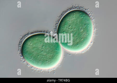 Blau-grüne Algen (Chroococcus spec.), blau-grünen Algen aus dem Tessin, differential Interferenz Kontrast, 160 x, Schweiz, Tessin Stockfoto