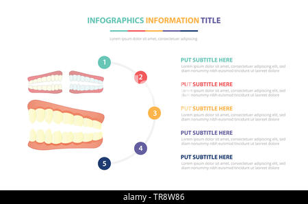 Menschliche Zähne Zahn Infografik Vorlage Konzept mit fünf Punkte Liste und verschiedene Farbe mit sauberen, modernen weißen Hintergrund - Vektor Lllustrat Stockfoto