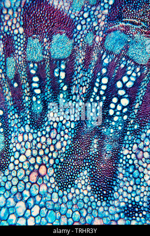 Die Klette Arctium Lappa, Stengel, Detail, hellfeld photomicrograph Stockfoto