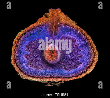 Porzellan Blume oder Wachs Pflanze, Hoya carnosa, Stiel, TS. darkfield Ablichtung. Stockfoto