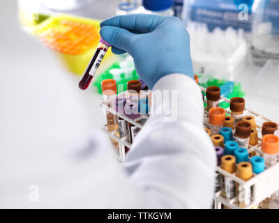 Nahaufnahme der Labortechniker holding Blutprobe für medizinische Prüfung Stockfoto