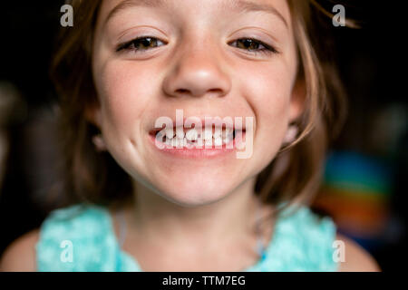 Close-up Portrait von Mädchen zeigen Kluft Zahn Stockfoto