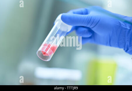 Hand Blut gießen in der Plastikflasche, Krankenhaus Labor. Stockfoto