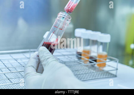 Hand Blut gießen in der Plastikflasche, Krankenhaus Labor. Stockfoto