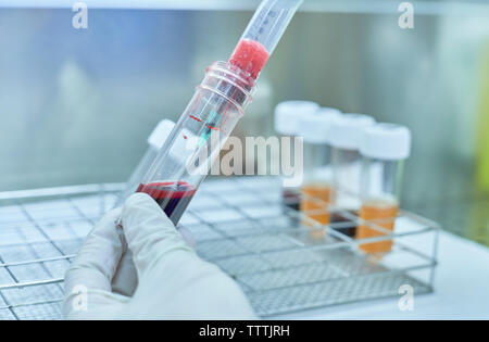 Hand Blut gießen in der Plastikflasche, Krankenhaus Labor. Stockfoto