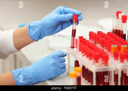 Wissenschaftler arbeiten mit Blutprobe im Labor Stockfoto