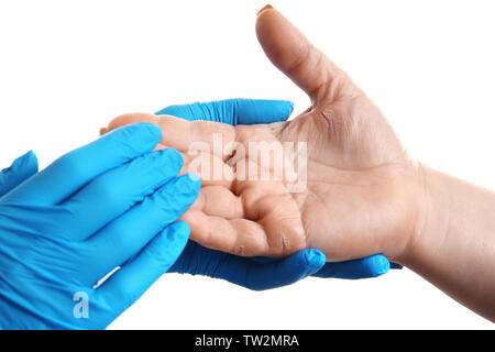 Arzt untersuchen Patienten mit Dermatitis an Hand, Nahaufnahme Stockfoto