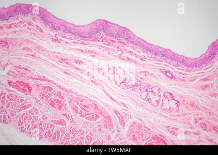 Längsschnitt durch die menschliche Speiseröhre, 100 mal durch optische Mikroskop vergrößert, H-E Färbung Stockfoto