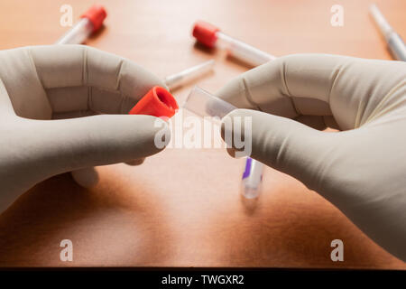 Pro-Koagulation Plain Clot Activator Blutentnahme Rohr, mit rotem Kunststoff Stopfen von Hand im Labor, in Indien statt. Stockfoto