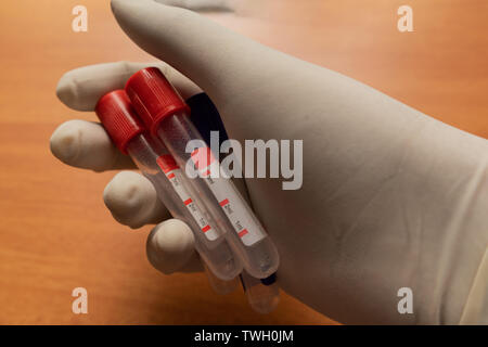 Pro-Koagulation Plain Clot Activator Blutentnahmeröhrchen, mit rotem Kunststoff Stopfen von Hand im Labor statt. Stockfoto