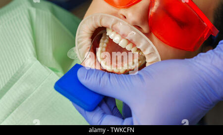 Zahnarzt untersucht den Zustand der Zähne des Oberkiefers von Mädchen Patienten. Zahnmedizinische Klinik. Health Care. Stockfoto