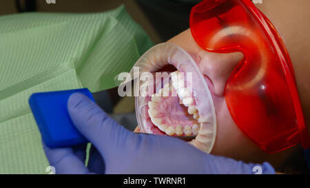 Zahnarzt untersucht den Zustand der Zähne des Oberkiefers des Mädchens Patienten. Prüfung durch einen Zahnarzt. Zahnmedizinische Klinik. Health Care. Stockfoto