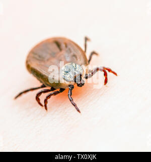 Enzephalitis Virus oder Lyme Krankheit infizierten Zecke Dermacentor Spinne Insekt auf der Haut Makro Stockfoto