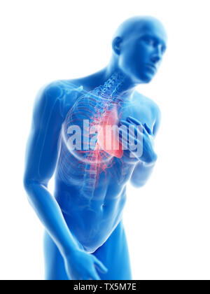 3D-gerenderte Abbildung: ein Mann mit Schmerzen in der Brust Stockfoto