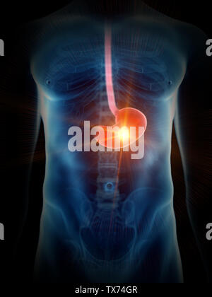 3D-gerenderte Medizinisch genaue Abbildung eines schmerzhaften Magen Stockfoto