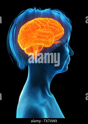 3D-gerenderte Medizinisch genaue Abbildung eines älteren Frauen im Gehirn Stockfoto