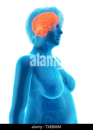 3D-gerenderte Medizinisch genaue Abbildung eines übergewichtigen womans Gehirn Stockfoto