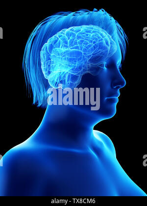 3D-gerenderte Medizinisch genaue Abbildung eines übergewichtigen womans Gehirn Stockfoto