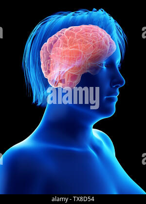 3D-gerenderte Medizinisch genaue Abbildung eines übergewichtigen womans Gehirn Stockfoto