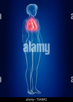 3D-gerenderte Medizinisch genaue Abbildung von Frauen eine schmerzhafte Lunge Stockfoto