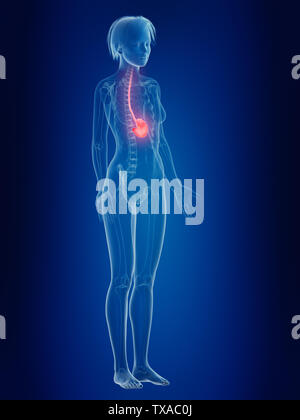 3D-gerenderte Medizinisch genaue Abbildung von Frauen eine schmerzhafte Magen Stockfoto