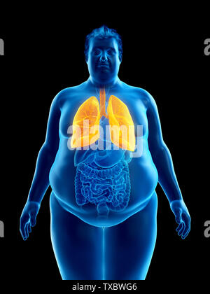 3D-gerenderte Medizinisch genaue Abbildung eines übergewichtigen mans Lungen Stockfoto