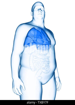 3D-gerenderte Medizinisch genaue Abbildung eines übergewichtigen mans Lunge Stockfoto