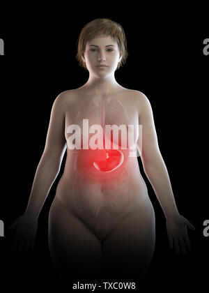 3D-gerenderte Medizinisch genaue Abbildung eines übergewichtigen Frauen schmerzhafte Magen Stockfoto