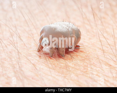 3D-gerenderte Medizinisch genaue Abbildung eines scabies mite auf der menschlichen Haut Stockfoto