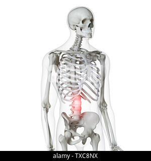 3D-gerenderte Medizinisch genaue Abbildung: Schmerzen im unteren Rücken Stockfoto