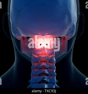 3D-gerenderte Medizinisch genaue Abbildung eines schmerzhaften Atlas Knochen Stockfoto