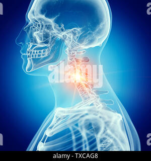 3D-gerenderte Medizinisch genaue Abbildung der Halswirbelsäule Stockfoto