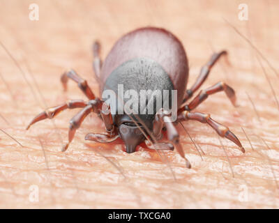 3D-gerenderte Abbildung: die Zecke in die menschliche Haut beißen Stockfoto