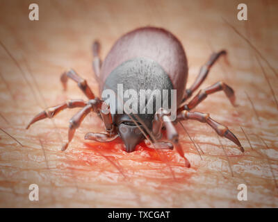 3D-gerenderte Abbildung: die Zecke in die menschliche Haut beißen Stockfoto