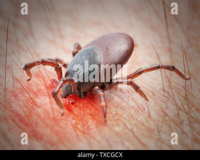 3D-gerenderte Abbildung: die Zecke in die menschliche Haut beißen Stockfoto