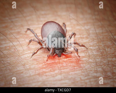 3D-gerenderte Abbildung: die Zecke in die menschliche Haut beißen Stockfoto